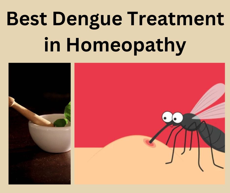Best Dengue Treatment in Homeopathy