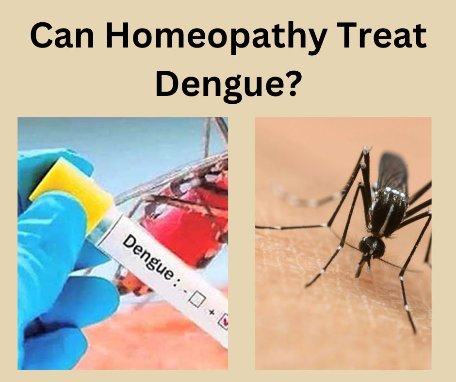 Can Homeopathy Treat Dengue