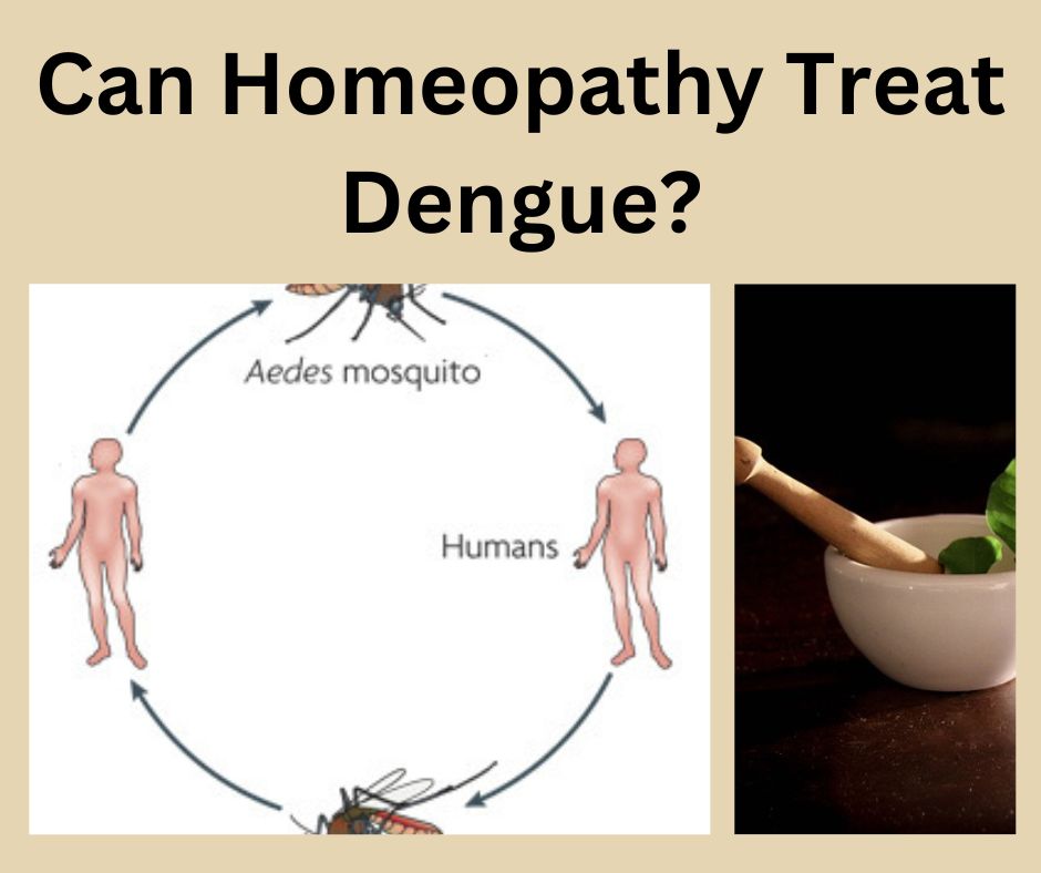 Can Homeopathy Treat Dengue